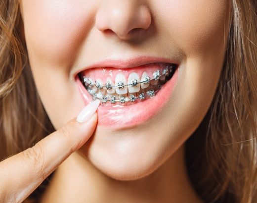 Adult orthodontia: Why it’s important
