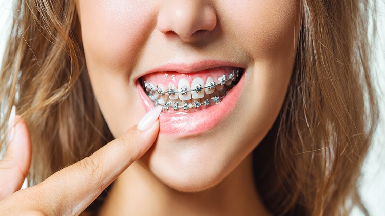 Adult orthodontia: Why it’s important