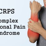 Understanding Long-Term Disability For Complex Regional Pain Syndrome