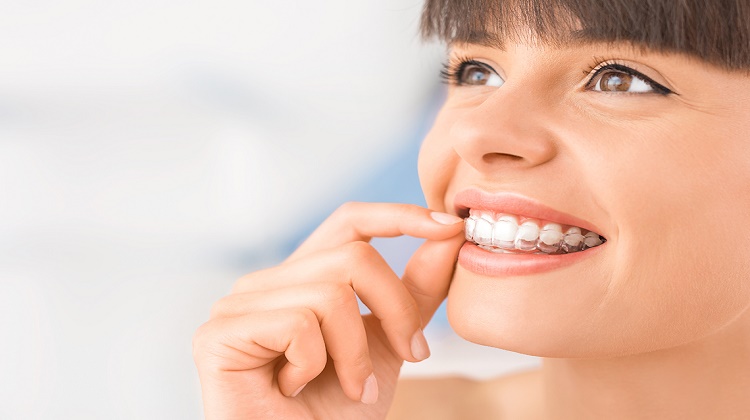 Reviewing the pros and cons of clear aligner treatment
